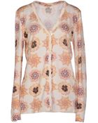 John Galliano Cardigan - Lyst