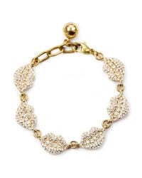 Lulu Frost - Metallic Le Baiser Multi Lip Bracelet - Lyst